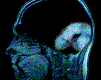 Emoticon Free nome do menino 121746